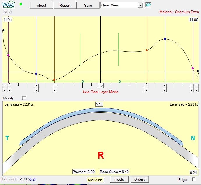 Hyperopic Presbyopia Ortho-K